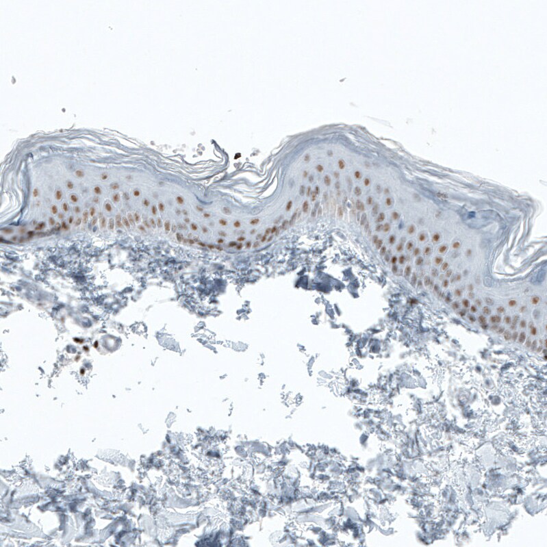 BCL11B Antibody (CL6426) - Azide and BSA Free Immunohistochemistry-Paraffin: BCL11B Antibody [NBP3-44407]