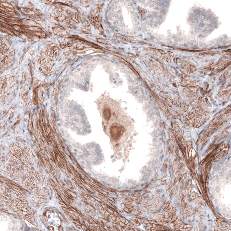 Laminin alpha 4 Antibody (CL3183) - Azide and BSA Free Immunohistochemistry-Paraffin: Laminin alpha 4 Antibody [NBP3-44408]
