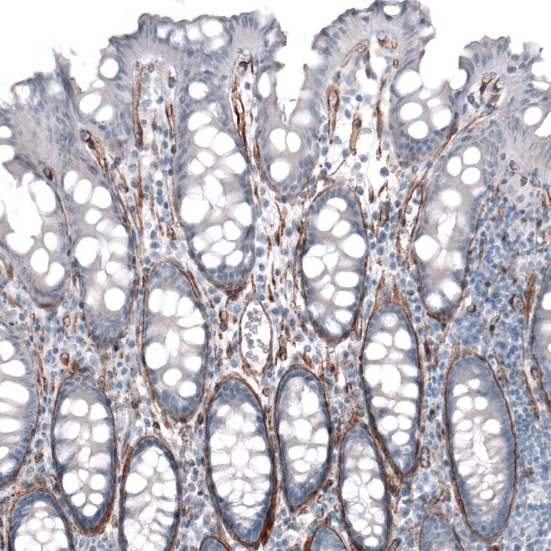 Laminin alpha 4 Antibody (CL3185) - Azide and BSA Free Immunohistochemistry-Paraffin: Laminin alpha 4 Antibody [NBP3-44409]