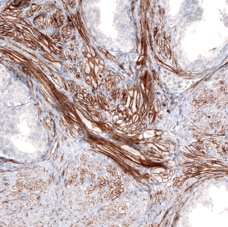 Laminin alpha 4 Antibody (CL3185) - Azide and BSA Free Immunohistochemistry-Paraffin: Laminin alpha 4 Antibody [NBP3-44409]