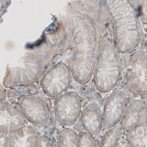 Laminin beta 1 Antibody (CL2970) - Azide and BSA Free Immunohistochemistry-Paraffin: Laminin beta 1 Antibody [NBP3-44411]