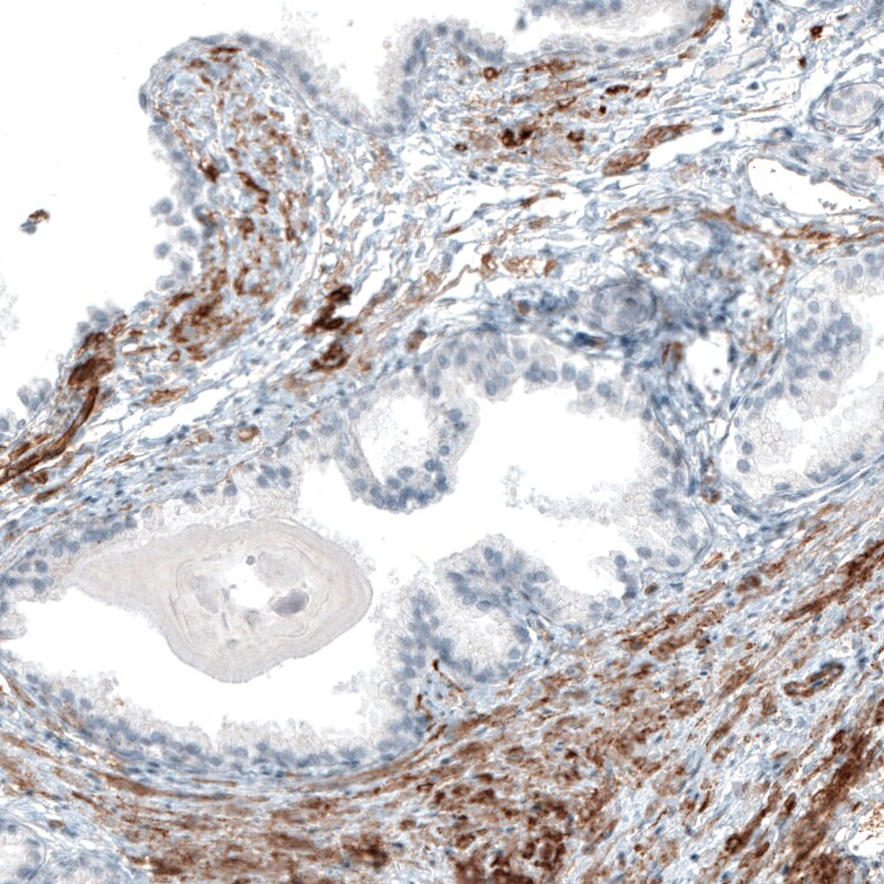 Integrin alpha 8 Antibody (CL7304) - Azide and BSA Free Immunohistochemistry-Paraffin: Integrin alpha 8 Antibody [NBP3-44412]