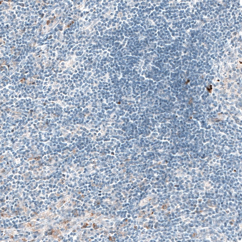 Sortilin Antibody (CL6526) - Azide and BSA Free Immunohistochemistry-Paraffin: Sortilin Antibody [NBP3-44414]