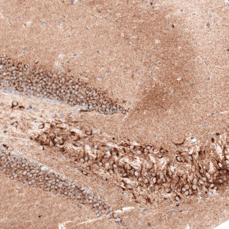 Sortilin Antibody (CL6528) - Azide and BSA Free Immunohistochemistry-Paraffin: Sortilin Antibody [NBP3-44415]
