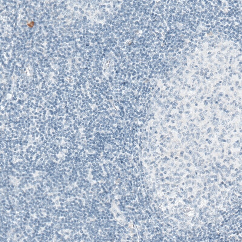 Sortilin Antibody (CL6528) - Azide and BSA Free Immunohistochemistry-Paraffin: Sortilin Antibody [NBP3-44415]