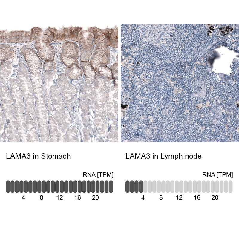 Laminin alpha 3 Antibody (CL3112) - Azide and BSA Free Immunohistochemistry-Paraffin: Laminin alpha 3 Antibody [NBP3-44416]