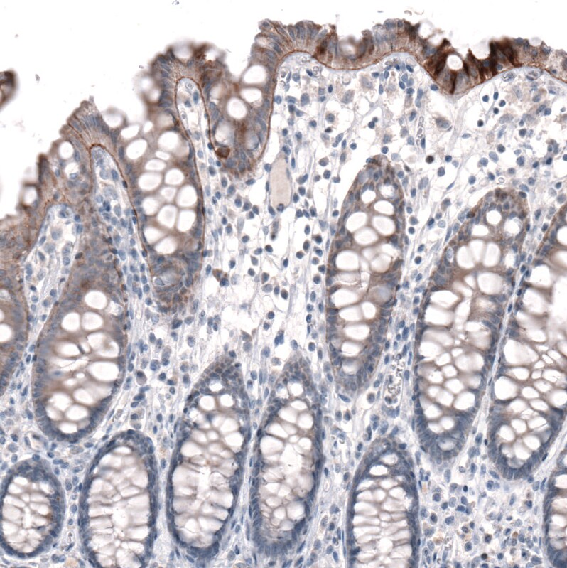 Laminin alpha 3 Antibody (CL3112) - Azide and BSA Free Immunohistochemistry-Paraffin: Laminin alpha 3 Antibody [NBP3-44416]