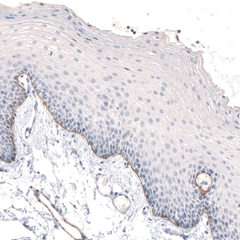 Laminin alpha 3 Antibody (CL3112) - Azide and BSA Free Immunohistochemistry-Paraffin: Laminin alpha 3 Antibody [NBP3-44416]