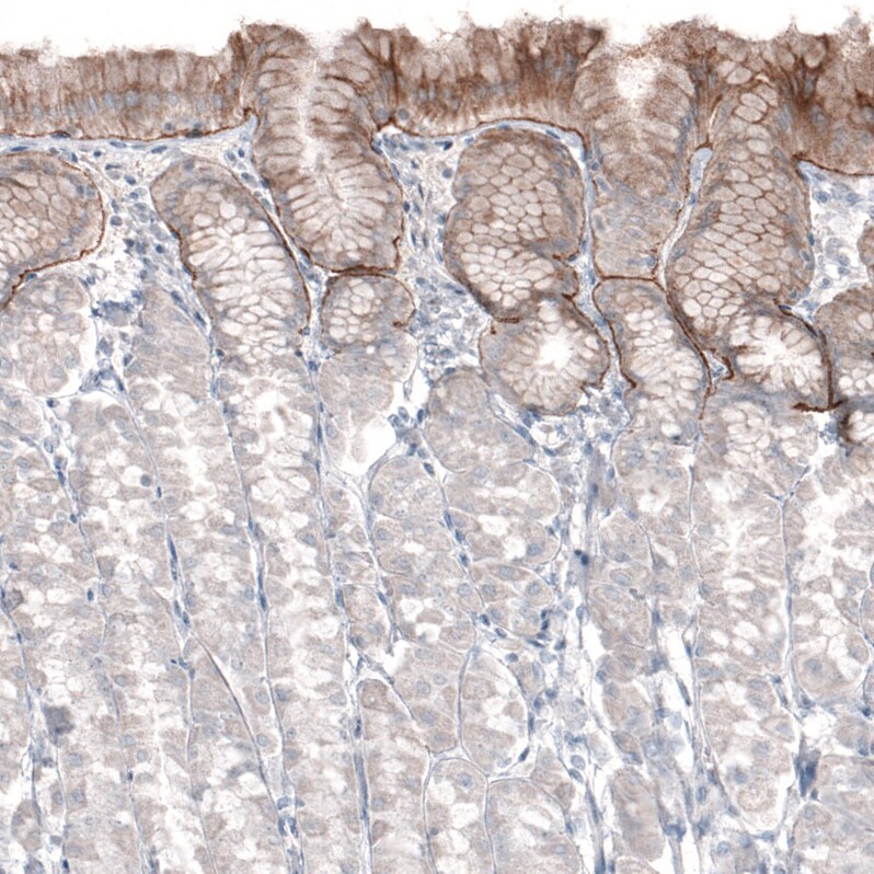 Laminin alpha 3 Antibody (CL3112) - Azide and BSA Free Immunohistochemistry-Paraffin: Laminin alpha 3 Antibody [NBP3-44416]