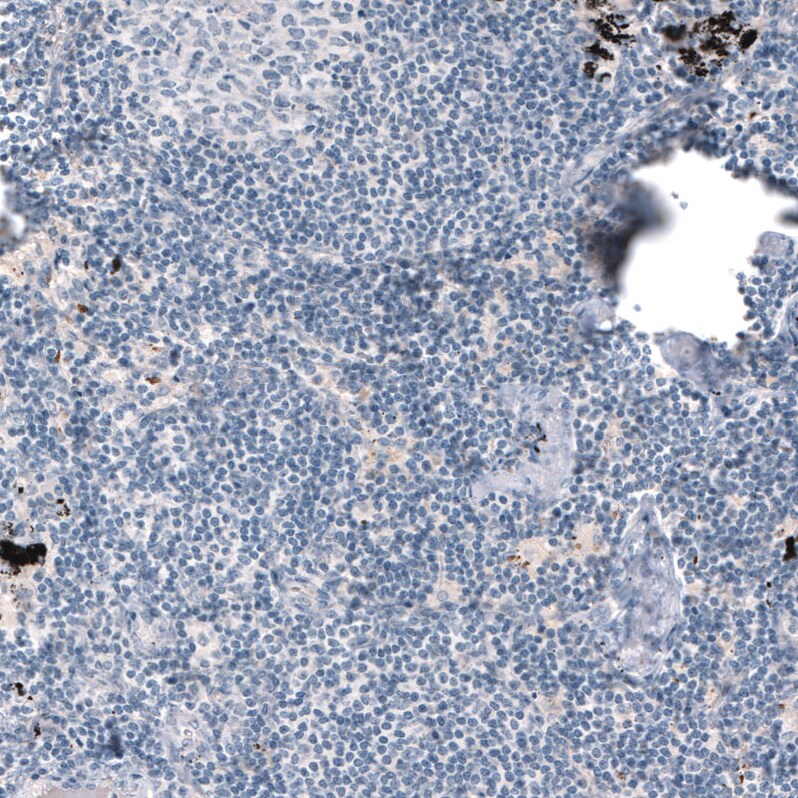 Laminin alpha 3 Antibody (CL3112) - Azide and BSA Free Immunohistochemistry-Paraffin: Laminin alpha 3 Antibody [NBP3-44416]