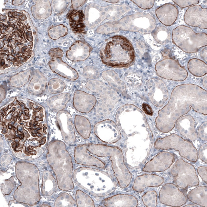 Laminin alpha 5 Antibody (CL3118) - Azide and BSA Free Immunohistochemistry-Paraffin: Laminin alpha 5 Antibody [NBP3-44417]