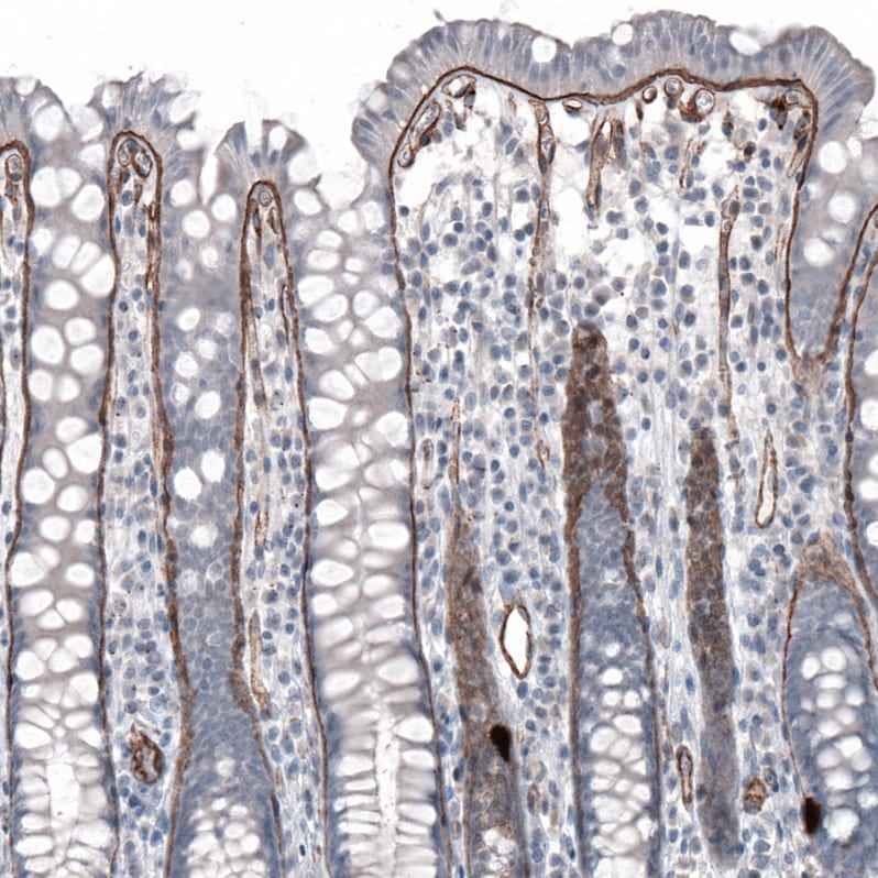 Laminin alpha 5 Antibody (CL3118) - Azide and BSA Free Immunohistochemistry-Paraffin: Laminin alpha 5 Antibody [NBP3-44417]