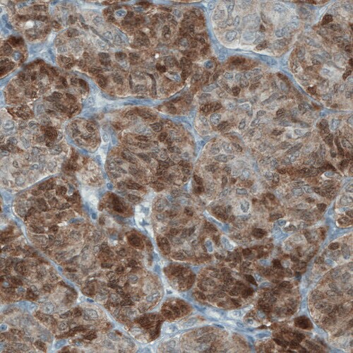 ASRGL1 Antibody (CL1679) - Azide and BSA Free Immunohistochemistry-Paraffin: ASRGL1 Antibody [NBP3-44418]