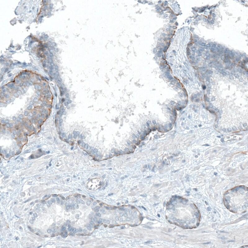 Integrin beta 4/CD104 Antibody (CL6972) - Azide and BSA Free Immunohistochemistry-Paraffin: Integrin beta 4/CD104 Antibody [NBP3-44419]