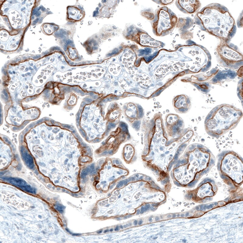 Integrin beta 4/CD104 Antibody (CL6972) - Azide and BSA Free Immunohistochemistry-Paraffin: Integrin beta 4/CD104 Antibody [NBP3-44419]