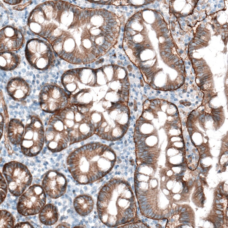 Integrin beta 4/CD104 Antibody (CL6973) - Azide and BSA Free Immunohistochemistry-Paraffin: Integrin beta 4/CD104 Antibody [NBP3-44420]