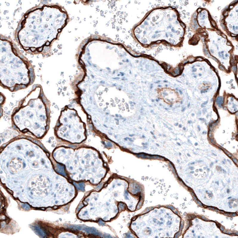 Integrin beta 4/CD104 Antibody (CL6973) - Azide and BSA Free Immunohistochemistry-Paraffin: Integrin beta 4/CD104 Antibody [NBP3-44420]