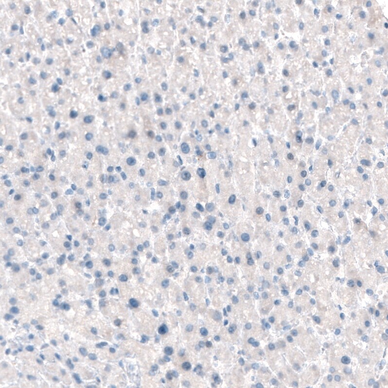 Integrin beta 4/CD104 Antibody (CL6973) - Azide and BSA Free Immunohistochemistry-Paraffin: Integrin beta 4/CD104 Antibody [NBP3-44420]