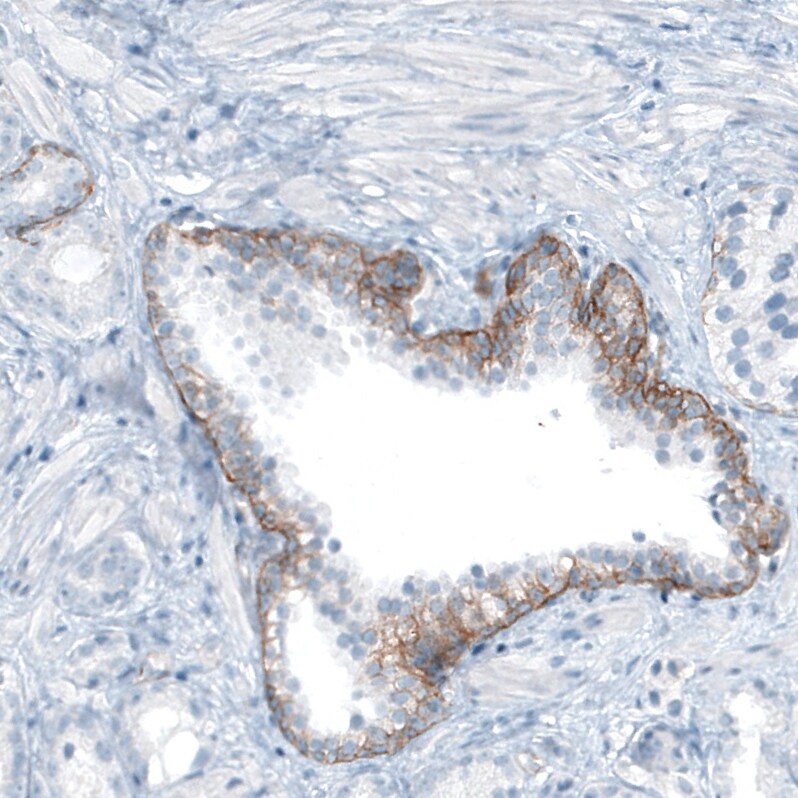 Integrin beta 4/CD104 Antibody (CL6973) - Azide and BSA Free Immunohistochemistry-Paraffin: Integrin beta 4/CD104 Antibody [NBP3-44420]