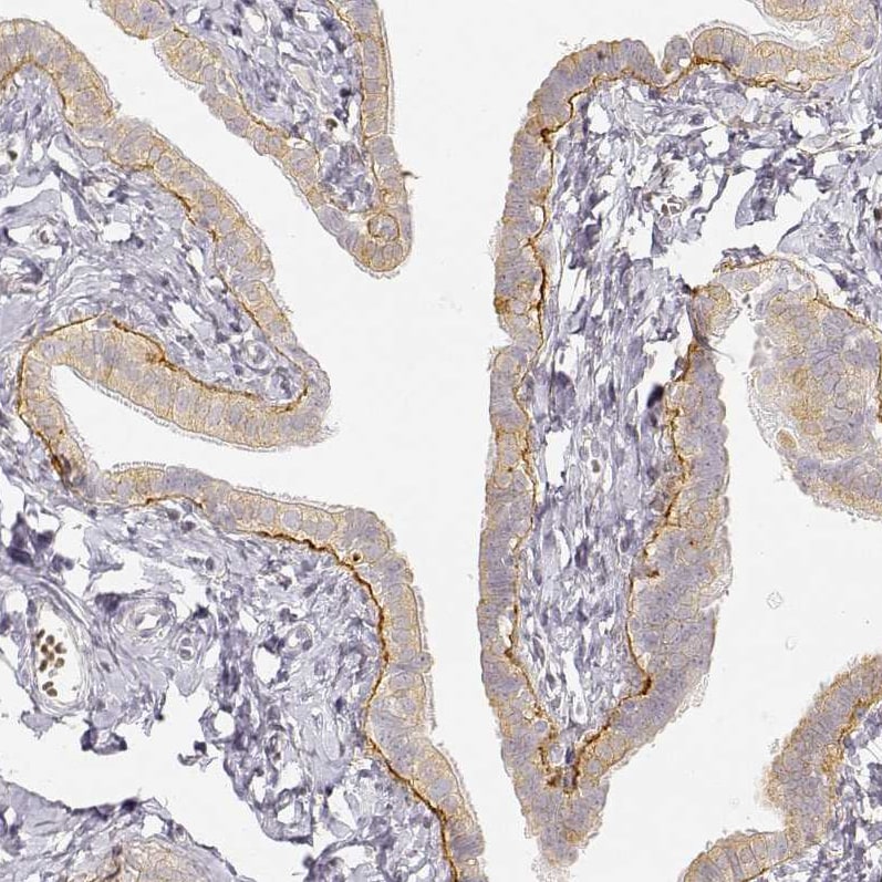 LAMC2 Antibody (CL2980) - Azide and BSA Free Immunohistochemistry-Paraffin: LAMC2 Antibody [NBP3-44421]