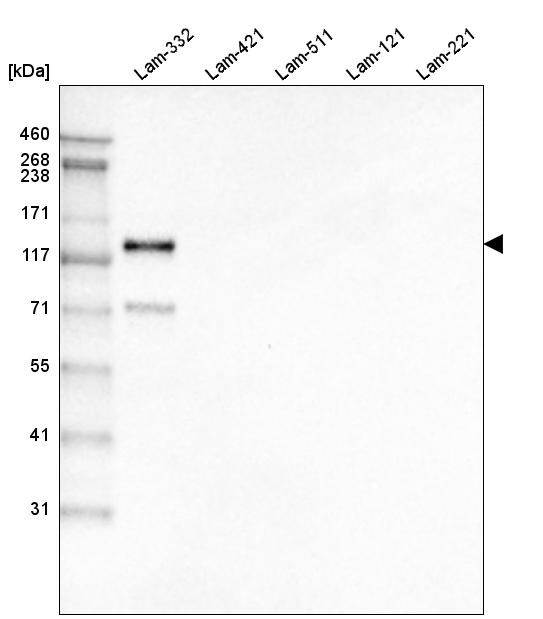 LAMC2 Antibody (CL2980) - Azide and BSA Free Western Blot: LAMC2 Antibody [NBP3-44421]