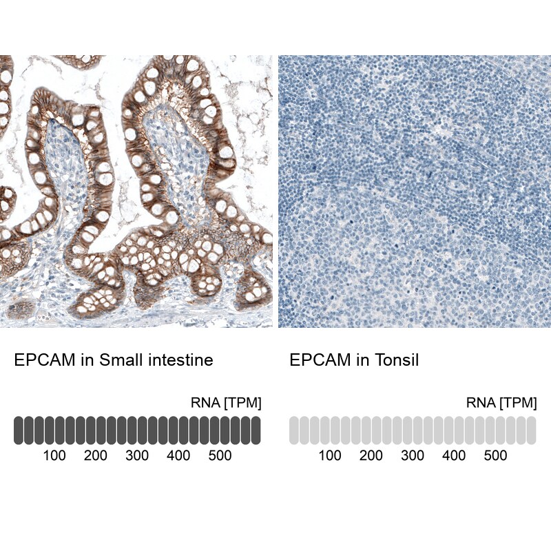 EpCAM/TROP1 Antibody (CL6313) - Azide and BSA Free Immunohistochemistry-Paraffin: EpCAM/TROP1 Antibody [NBP3-44423]