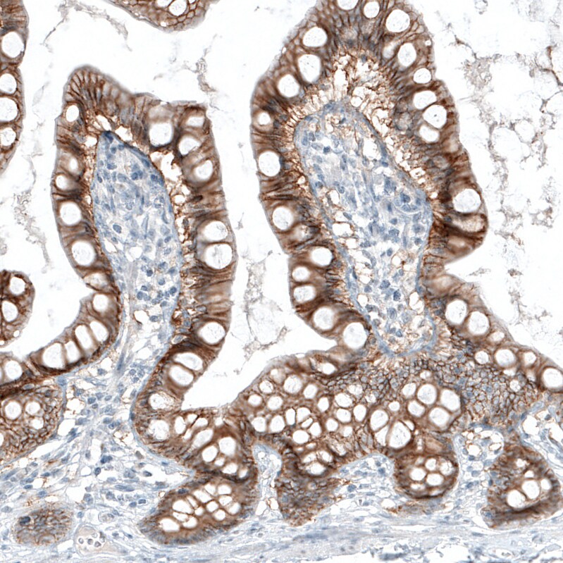EpCAM/TROP1 Antibody (CL6313) - Azide and BSA Free Immunohistochemistry-Paraffin: EpCAM/TROP1 Antibody [NBP3-44423]