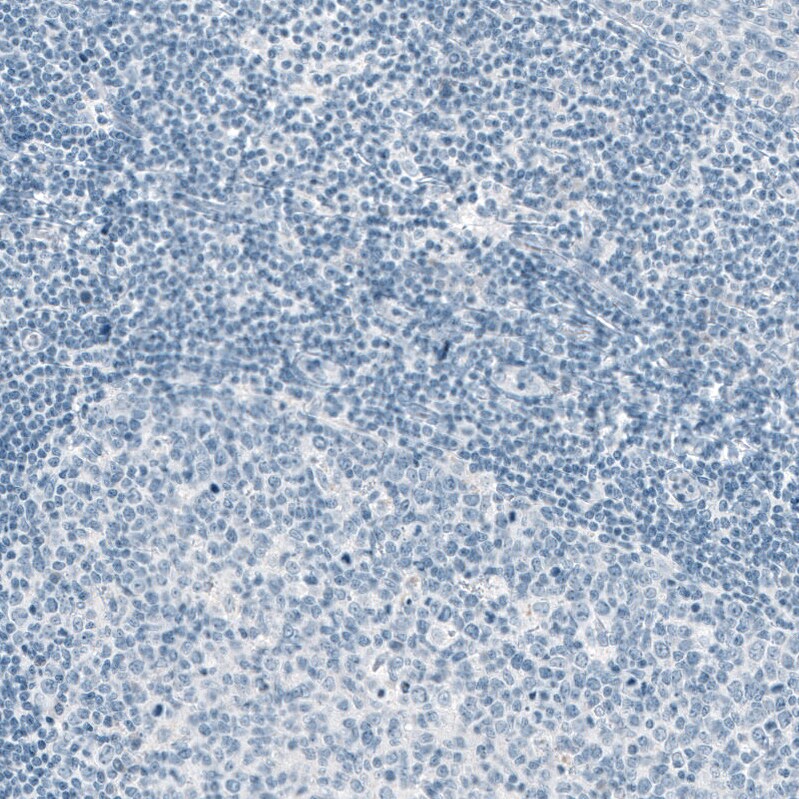 EpCAM/TROP1 Antibody (CL6313) - Azide and BSA Free Immunohistochemistry-Paraffin: EpCAM/TROP1 Antibody [NBP3-44423]