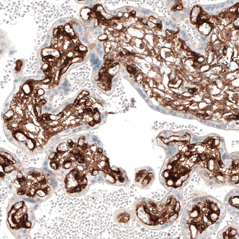 Integrin alpha 1/CD49a Antibody (CL7207) - Azide and BSA Free Immunohistochemistry-Paraffin: Integrin alpha 1/CD49a Antibody [NBP3-44430]