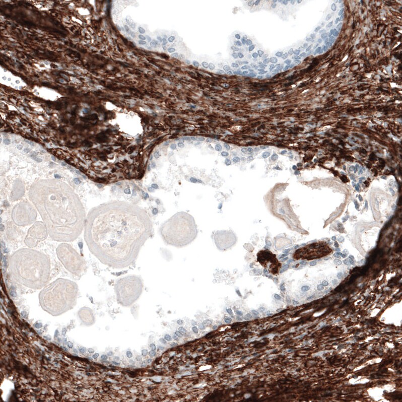 Integrin alpha 1/CD49a Antibody (CL7207) - Azide and BSA Free Immunohistochemistry-Paraffin: Integrin alpha 1/CD49a Antibody [NBP3-44430]
