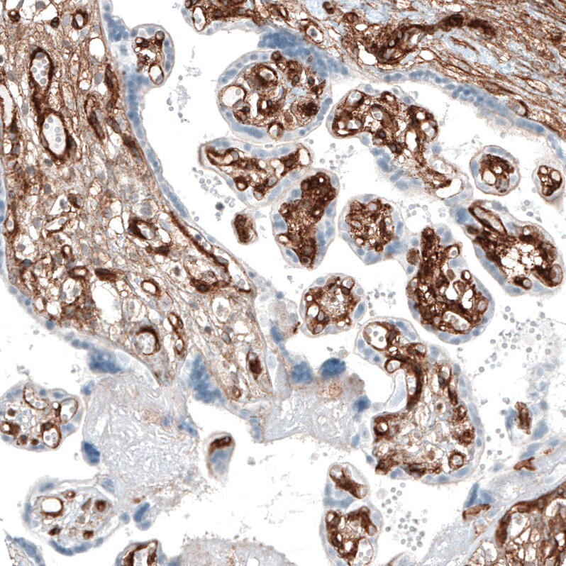 Integrin alpha 1/CD49a Antibody (CL7217) - Azide and BSA Free Immunohistochemistry-Paraffin: Integrin alpha 1/CD49a Antibody [NBP3-44431]