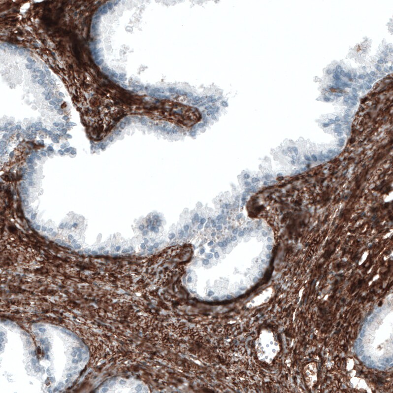 Integrin alpha 1/CD49a Antibody (CL7217) - Azide and BSA Free Immunohistochemistry-Paraffin: Integrin alpha 1/CD49a Antibody [NBP3-44431]