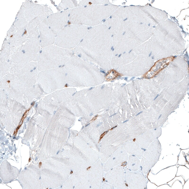 Integrin alpha 1/CD49a Antibody (CL7217) - Azide and BSA Free Immunohistochemistry-Paraffin: Integrin alpha 1/CD49a Antibody [NBP3-44431]
