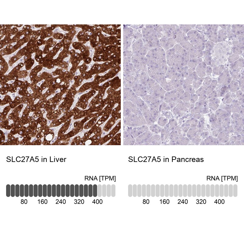 FATP5/SLC27A5 Antibody (CL0213) - Azide and BSA Free Immunohistochemistry-Paraffin: FATP5/SLC27A5 Antibody [NBP3-44432]