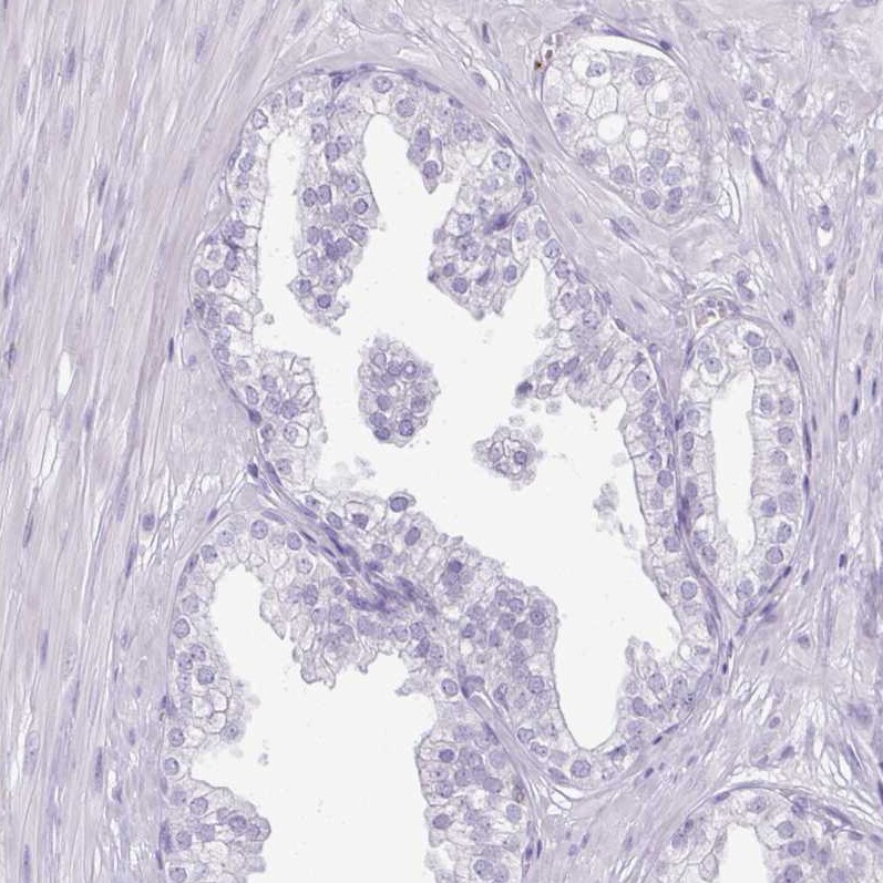 FATP5/SLC27A5 Antibody (CL0213) - Azide and BSA Free Immunohistochemistry-Paraffin: FATP5/SLC27A5 Antibody [NBP3-44432]