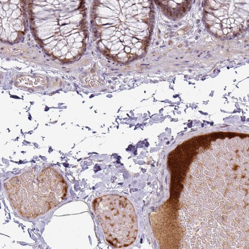Apolipoprotein L1 Antibody (CL0171) - Azide and BSA Free Immunohistochemistry-Paraffin: Apolipoprotein L1 Antibody [NBP3-44434]