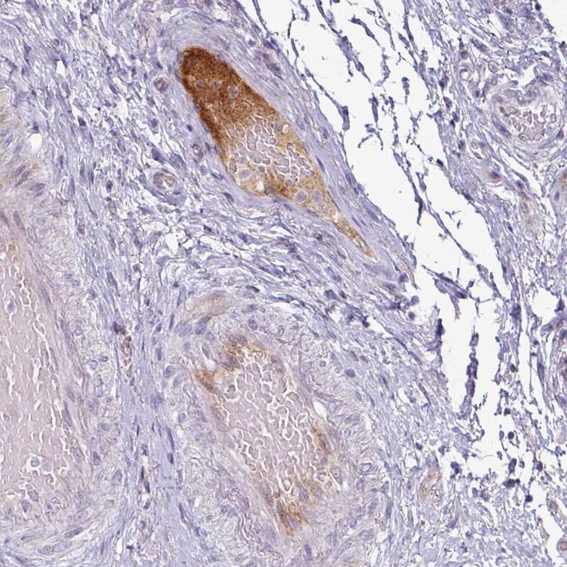 Apolipoprotein L1 Antibody (CL0171) - Azide and BSA Free Immunohistochemistry-Paraffin: Apolipoprotein L1 Antibody [NBP3-44434]