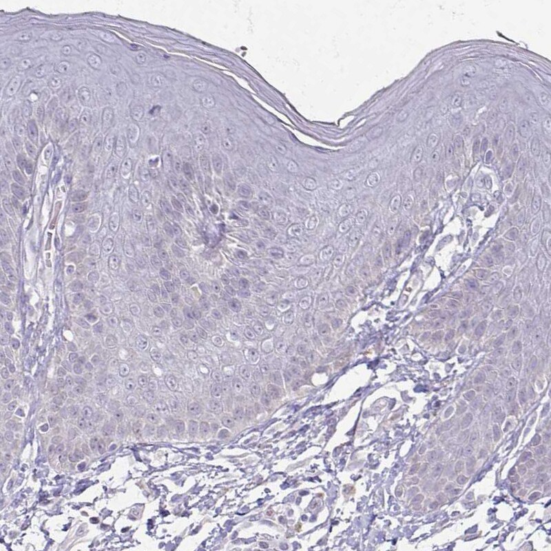 Apolipoprotein L1 Antibody (CL0171) - Azide and BSA Free Immunohistochemistry-Paraffin: Apolipoprotein L1 Antibody [NBP3-44434]