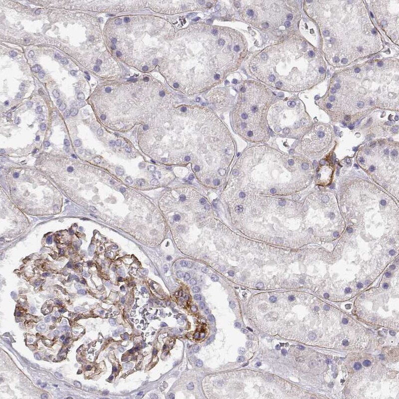 Laminin gamma 1 Antibody (CL3199) - Azide and BSA Free Immunohistochemistry-Paraffin: Laminin gamma 1 Antibody [NBP3-44435]