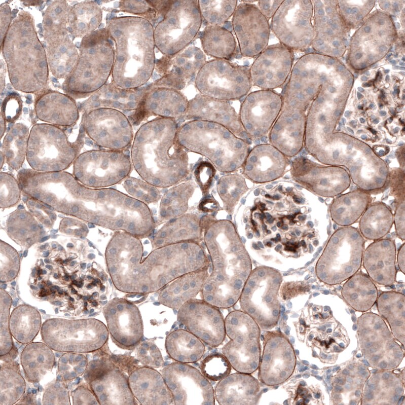 Laminin gamma 1 Antibody (CL3199) - Azide and BSA Free Immunohistochemistry-Paraffin: Laminin gamma 1 Antibody [NBP3-44435]