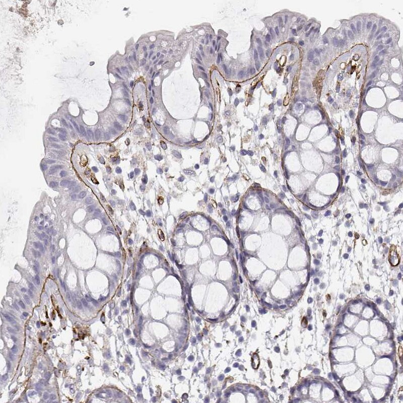 Laminin gamma 1 Antibody (CL3199) - Azide and BSA Free Immunohistochemistry-Paraffin: Laminin gamma 1 Antibody [NBP3-44435]