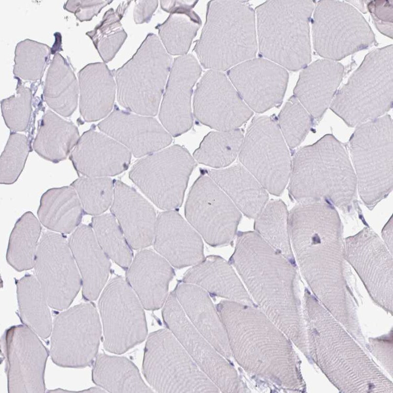ATAD2 Antibody (CL0182) - Azide and BSA Free Immunohistochemistry-Paraffin: ATAD2 Antibody [NBP3-44437]