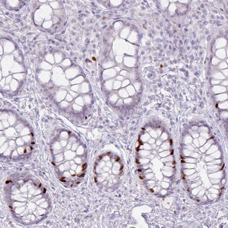ATAD2 Antibody (CL0182) - Azide and BSA Free Immunohistochemistry-Paraffin: ATAD2 Antibody [NBP3-44437]