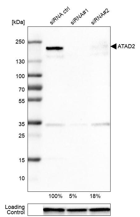 ATAD2 Antibody (CL0182) - Azide and BSA Free Western Blot: ATAD2 Antibody [NBP3-44437]