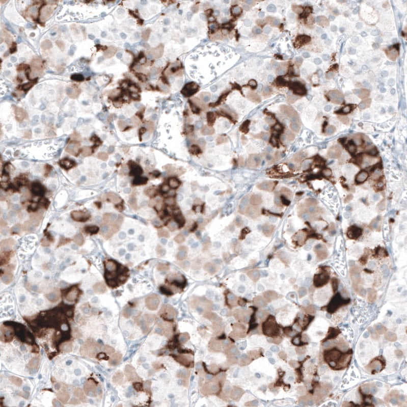 Prolactin Antibody (CL6550) - Azide and BSA Free Immunohistochemistry-Paraffin: Prolactin Antibody [NBP3-44438]