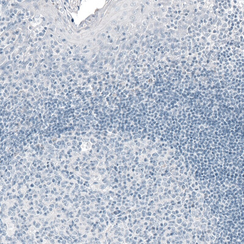 Prolactin Antibody (CL6550) - Azide and BSA Free Immunohistochemistry-Paraffin: Prolactin Antibody [NBP3-44438]