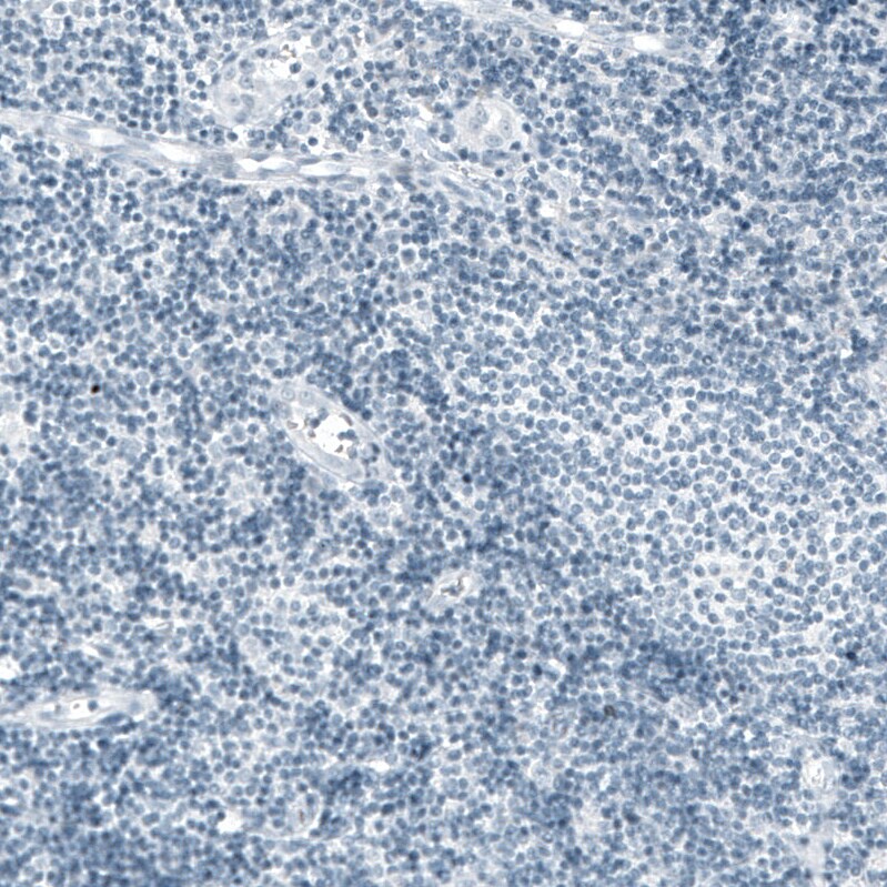 Prolactin Antibody (CL6559) - Azide and BSA Free Immunohistochemistry-Paraffin: Prolactin Antibody [NBP3-44440]