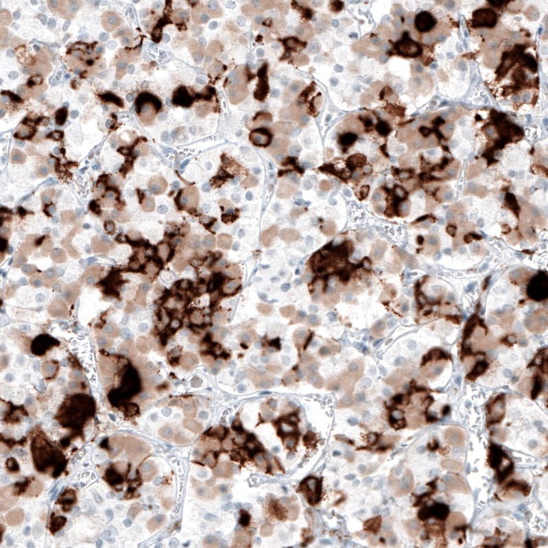 Prolactin Antibody (CL6559) - Azide and BSA Free Immunohistochemistry-Paraffin: Prolactin Antibody [NBP3-44440]