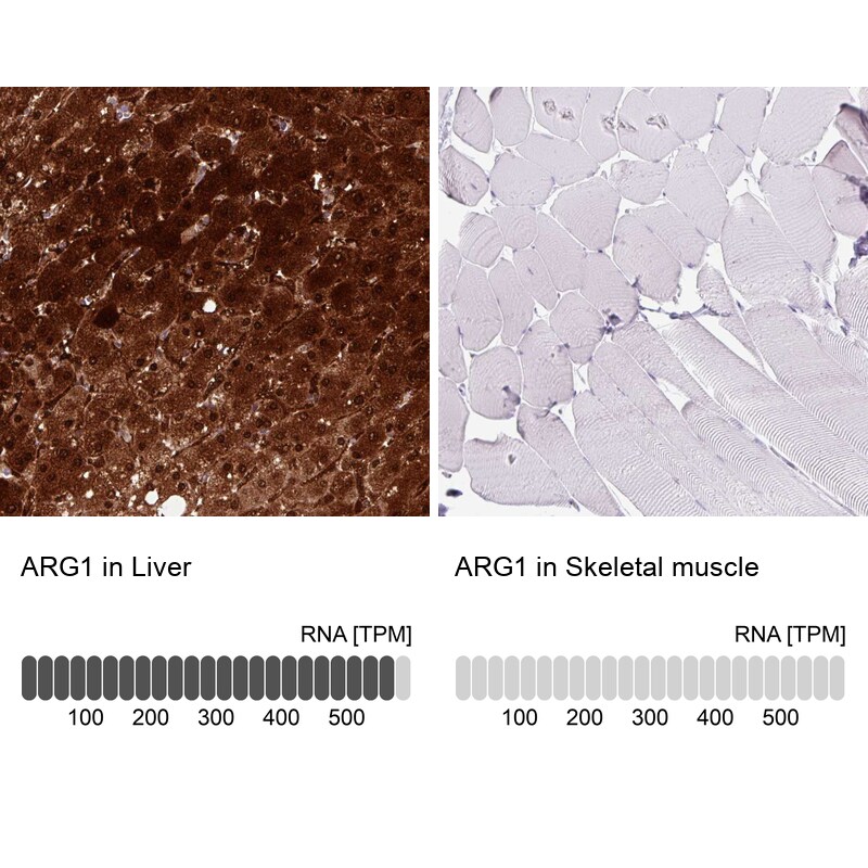 Arginase 1/ARG1/liver Arginase Antibody (CL0186) - Azide and BSA Free Immunohistochemistry-Paraffin: Arginase 1/ARG1/liver Arginase Antibody [NBP3-44441]
