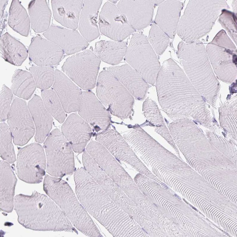 Arginase 1/ARG1/liver Arginase Antibody (CL0186) - Azide and BSA Free Immunohistochemistry-Paraffin: Arginase 1/ARG1/liver Arginase Antibody [NBP3-44441]